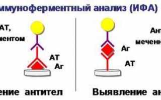 Диагностика паразитов в организме: анализы и исследования