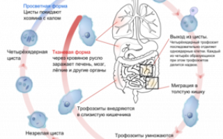 Амебиаз: симптомы, лечение, диагностика