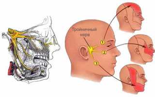 Симптомы заболевания тройничного нерва и лечение