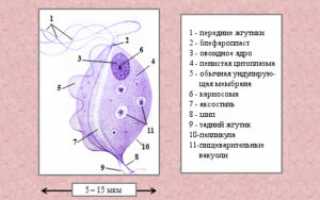 Трихомонады у мужчин: симптомы и лечение, диагностика и особенности протекания