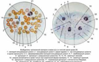 Как проводится анализ на малярию?