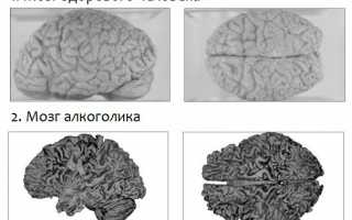 Последствия и лечение алкогольной ломки