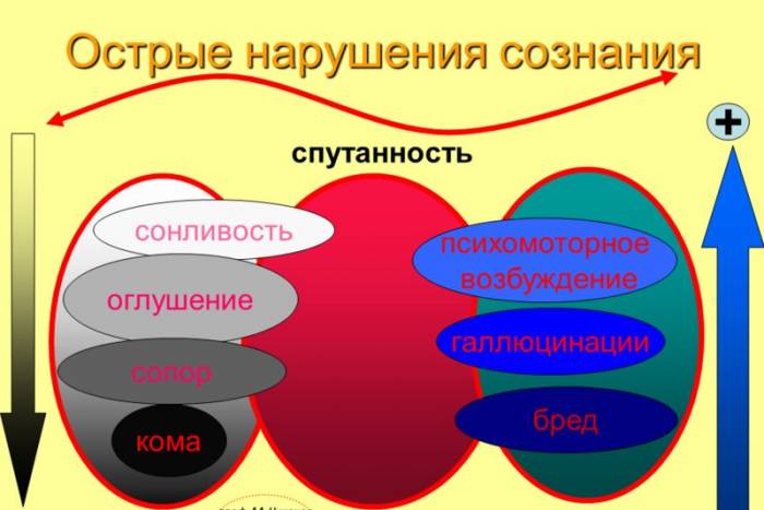 Острые нарушения сознания