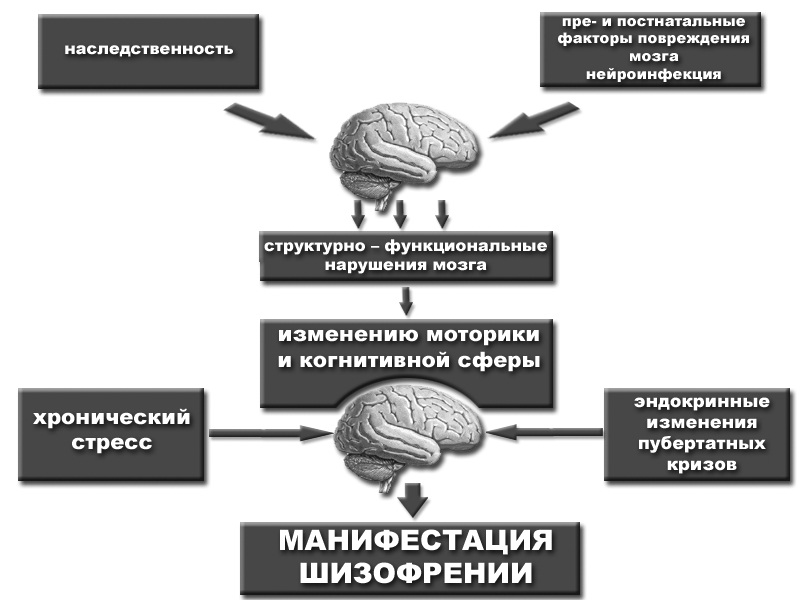 Схема возможных причин развития шизофрении