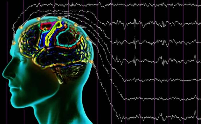 Исследование мозга при эпилепсии